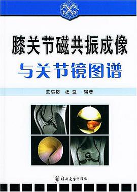 膝关节磁共振成像与关节镜图谱 pdf epub mobi 电子书 下载