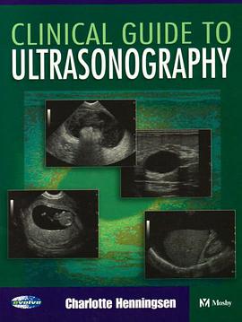超声临床指南Clinical Guide to Ultrasonography pdf epub mobi 电子书 下载