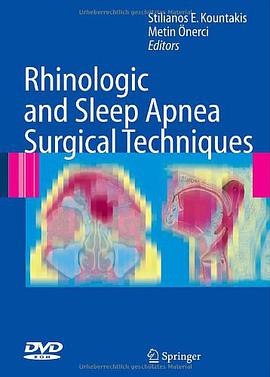 Rhinologic and Sleep Apnea Surgical Techniques pdf epub mobi 电子书 下载