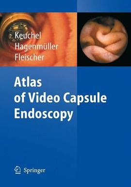 Atlas of Video Capsule Endoscopy pdf epub mobi 电子书 下载