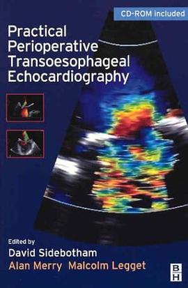 Practical Perioperative Transoesophageal Echocardiography pdf epub mobi 电子书 下载