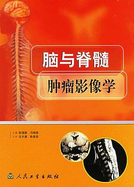 脑与脊髓肿瘤影像学 pdf epub mobi 电子书 下载