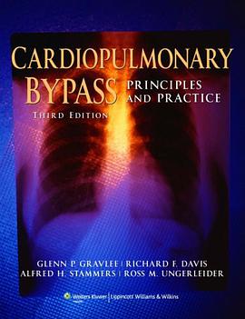 Cardiopulmonary Bypass pdf epub mobi 电子书 下载