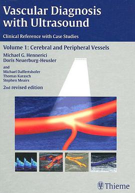 Vascular Diagnosis with Ultrasound pdf epub mobi 电子书 下载