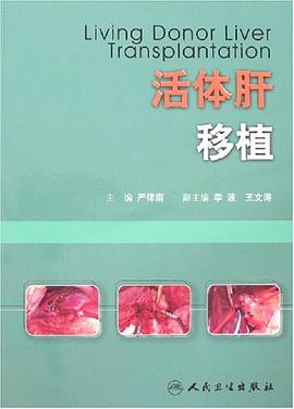 活体肝移植 pdf epub mobi 电子书 下载