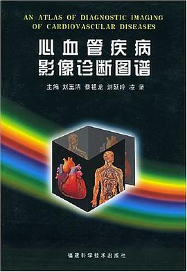 心血管疾病影像诊断图谱 pdf epub mobi 电子书 下载