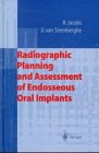 Radiographic Planning and Assessment of Endosseous Oral Implants pdf epub mobi 电子书 下载