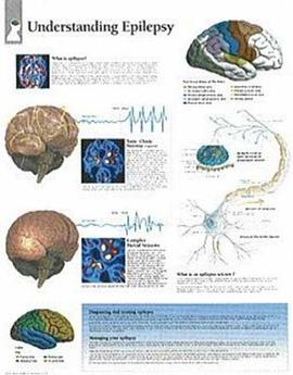 Understanding Epilepsy pdf epub mobi 电子书 下载