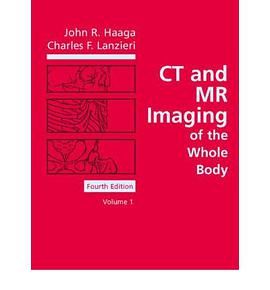Ct and Mr Imaging of the Whole Body pdf epub mobi 电子书 下载