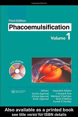 Phacoemulsification pdf epub mobi 电子书 下载