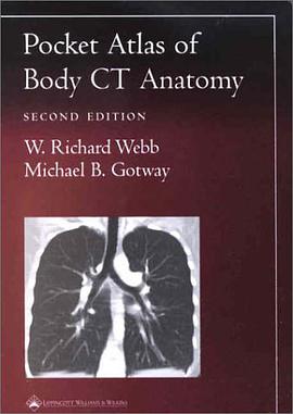 Pocket Atlas of Body CT Anatomy pdf epub mobi 電子書 下載