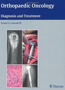 Orthopaedic Oncology pdf epub mobi 电子书 下载
