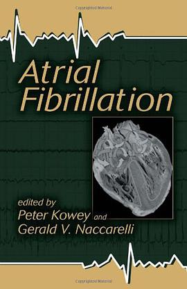 Atrial Fibrillation pdf epub mobi 电子书 下载