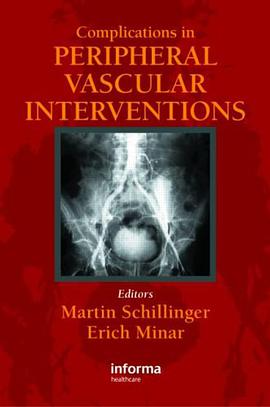 Complicatons in Peripheral Vascular Interventions pdf epub mobi 電子書 下載