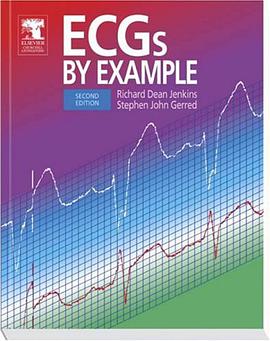 ECGs by Example pdf epub mobi 电子书 下载