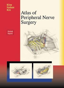 Atlas of Peripheral Nerve Surgery pdf epub mobi 电子书 下载