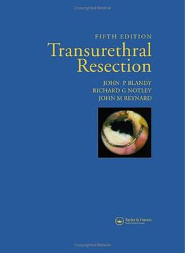 Transurethral Resection, Fifth Edition pdf epub mobi 电子书 下载