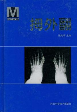 拇外翻 pdf epub mobi 电子书 下载