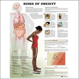 Risks of Obesity Anatomical Chart pdf epub mobi 电子书 下载
