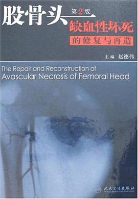 股骨头缺血性坏死的修复与再造 pdf epub mobi 电子书 下载