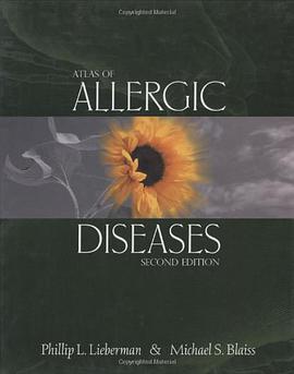 Atlas of Allergic Diseases pdf epub mobi 电子书 下载