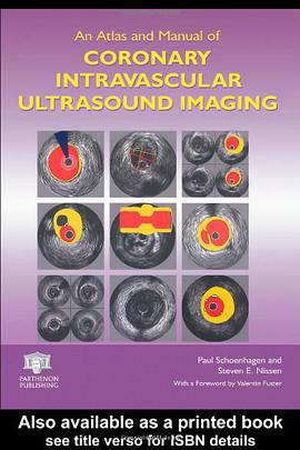 An Atlas and Manual of Coronary Intravascular Ultrasound Imaging pdf epub mobi 电子书 下载