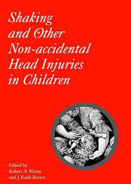 Shaking and Other Non-Accidental Head Injuries in Children pdf epub mobi 电子书 下载