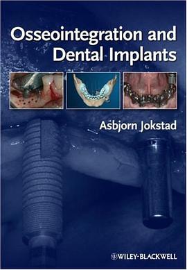 Osseointegration and Dental Implants pdf epub mobi 电子书 下载