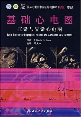 基础心电图 pdf epub mobi 电子书 下载