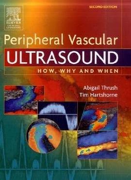 Peripheral Vascular Ultrasound pdf epub mobi 电子书 下载