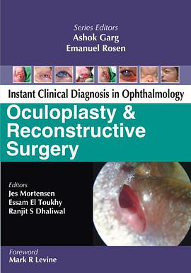 Oculoplasty and Reconstructive Surgery (Instant Clinical Diagnosis in Ophthalmology)
