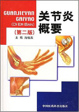 关节炎概要 pdf epub mobi 电子书 下载