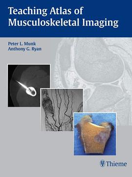 Teaching Atlas of Musculoskeletal Imaging pdf epub mobi 电子书 下载