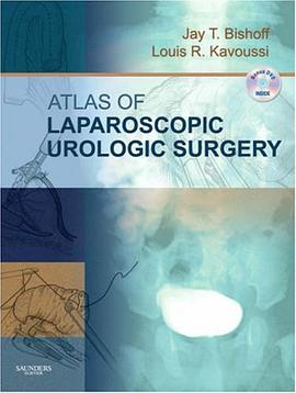 Atlas of Laparoscopic Urologic Surgery with DVD pdf epub mobi 电子书 下载