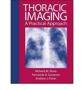 Thoracic Imaging pdf epub mobi 电子书 下载