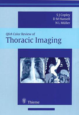 Thoracic Imaging pdf epub mobi 电子书 下载