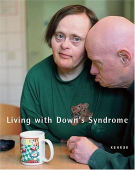 Living with Down Syndrome/Menschen Mit Down-Syndrom pdf epub mobi 电子书 下载