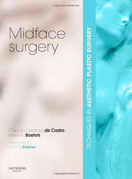 Midface Surgery pdf epub mobi 电子书 下载