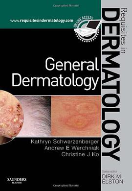 General Dermatology pdf epub mobi 下载