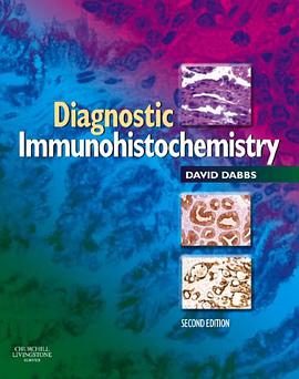Diagnostic Immunohistochemistry pdf epub mobi 电子书 下载