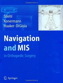 Navigation and MIS in Orthopedic Surgery pdf epub mobi 电子书 下载