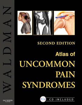 Atlas of Uncommon Pain Syndromes pdf epub mobi 电子书 下载