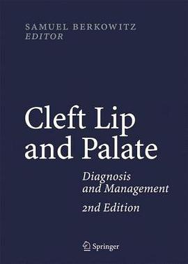 Cleft Lip and Palate pdf epub mobi 电子书 下载