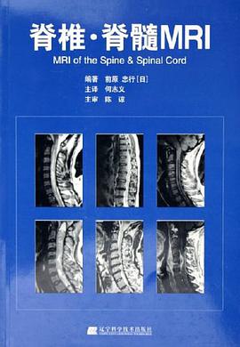 脊椎·脊髓MRI pdf epub mobi 电子书 下载