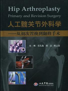 人工髋关节外科学.从初次置换到翻修手术