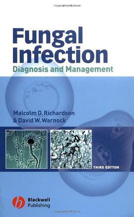Fungal Infection pdf epub mobi 电子书 下载