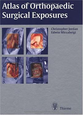 Atlas of Orthopaedic Surgical Exposures pdf epub mobi 电子书 下载