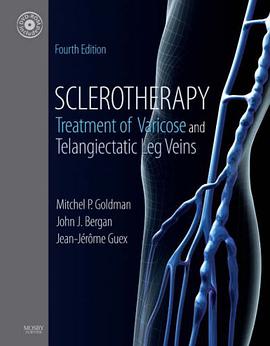 Sclerotherapy pdf epub mobi 电子书 下载