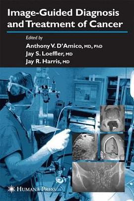 Image-Guided Diagnosis and Treatment of Cancer pdf epub mobi 电子书 下载