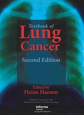 Textbook of Lung Cancer pdf epub mobi 電子書 下載